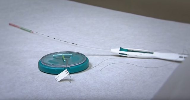 Fotografija novorođenčeta sa spiralom u ruci obišla svet